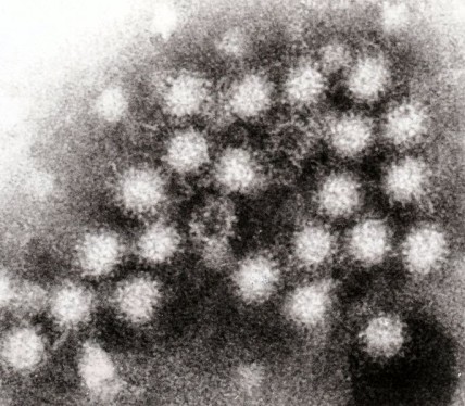 Norovirus