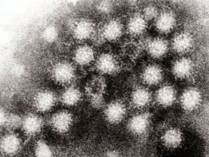 Norovirus