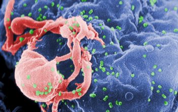 Scanning electron micrograph of HIV-1 budding (in green) from cultured lymphocyte