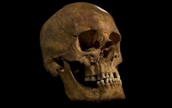 Skull of Richard III