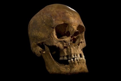 Skull of Richard III
