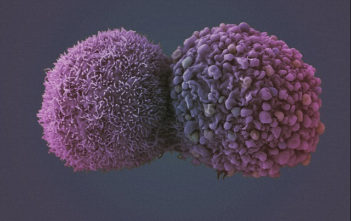 Lung cancer cells