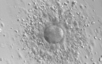 An oocyte, or egg cell, surrounded by some supporting cells.