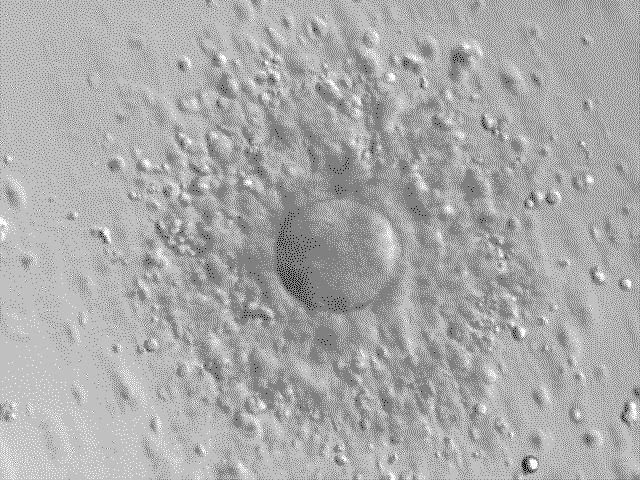 An oocyte, or egg cell, surrounded by some supporting cells.