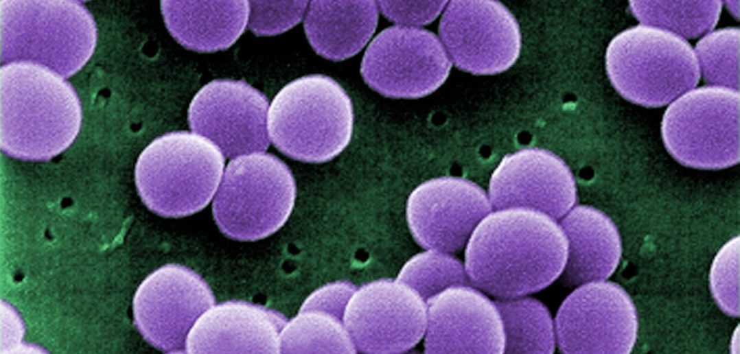 Scanning electron micrograph of Staphylococcus Aureus with increased resistance to vancomycin