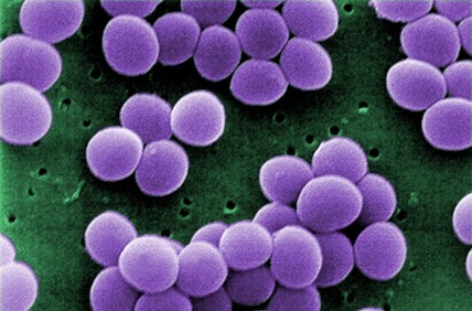 Scanning electron micrograph of Staphylococcus Aureus with increased resistance to vancomycin