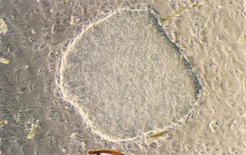 Undifferentiated embryonic stem cells