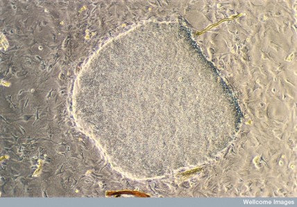 Undifferentiated embryonic stem cells