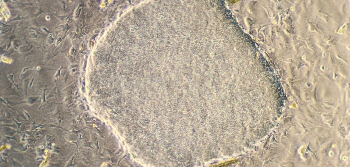 Undifferentiated embryonic stem cells