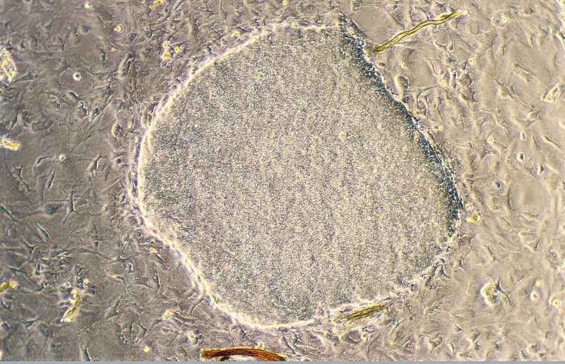 Undifferentiated embryonic stem cells