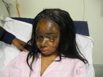 Naomi Oni in hospital after she was attacked with acid