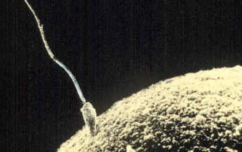 Sperm