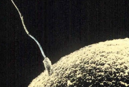 Sperm