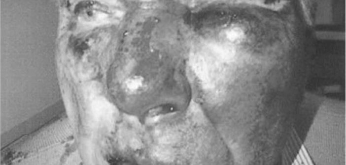Brutal attack on pensioner in Nottinghamshire