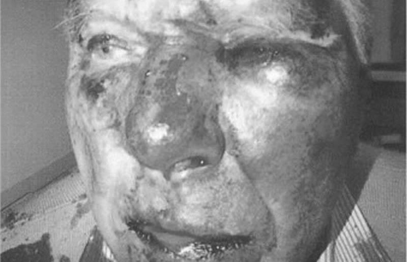 Brutal attack on pensioner in Nottinghamshire