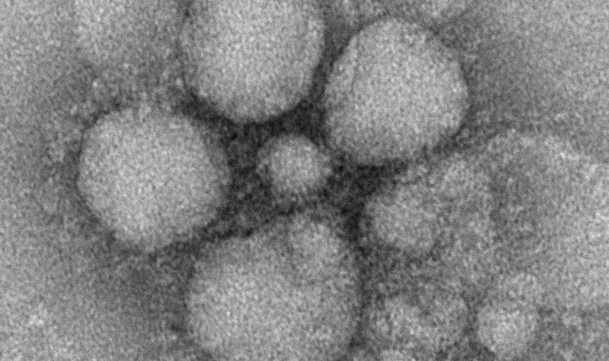 MERS coronavirus