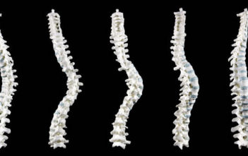 3D model of Richard III's spine