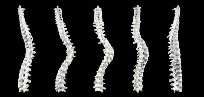 3D model of Richard III's spine