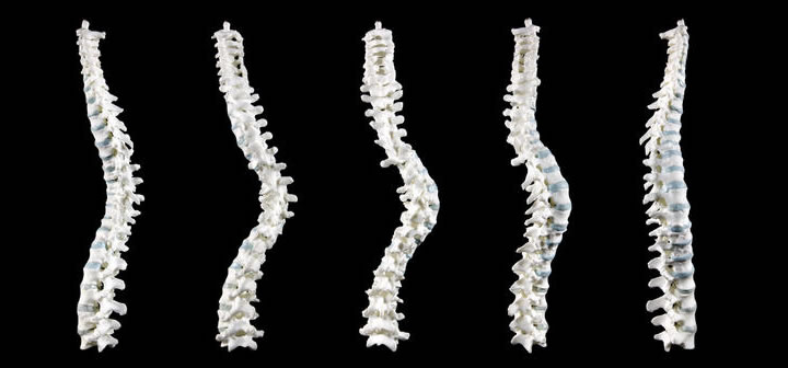 3D model of Richard III's spine