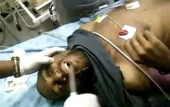 Mobile phone stuck in man's mouth