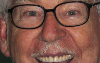 Rolf Harris