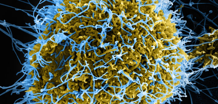 Ebola virus