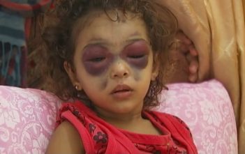 Child victim in Gaza