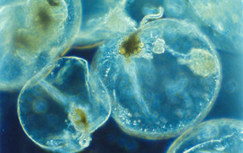 Noctiluca scintillans