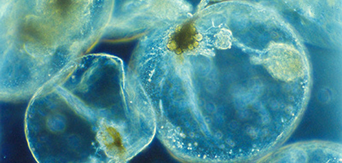 Noctiluca scintillans