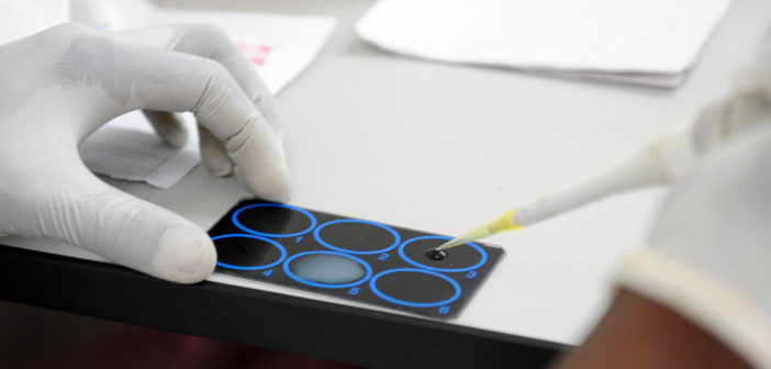 Medical sample testing