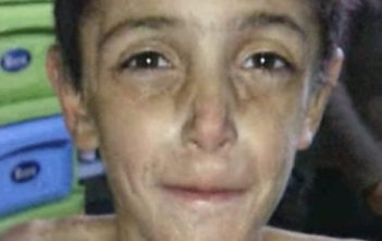 Starvation in Madaya, Syria