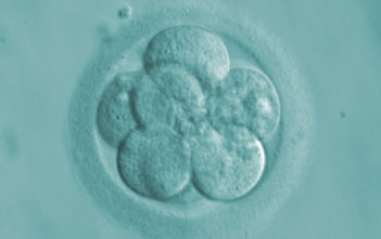 Human 8-cell embryo (72 hours)
