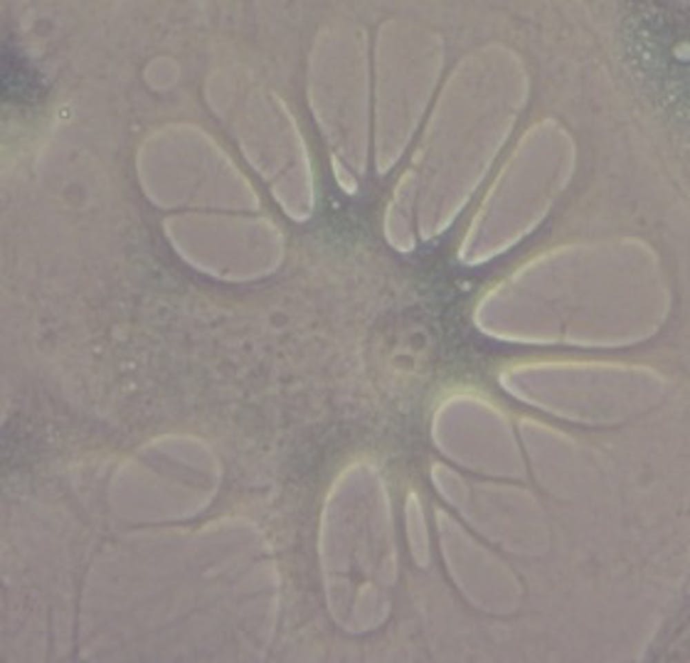 Senescent cell